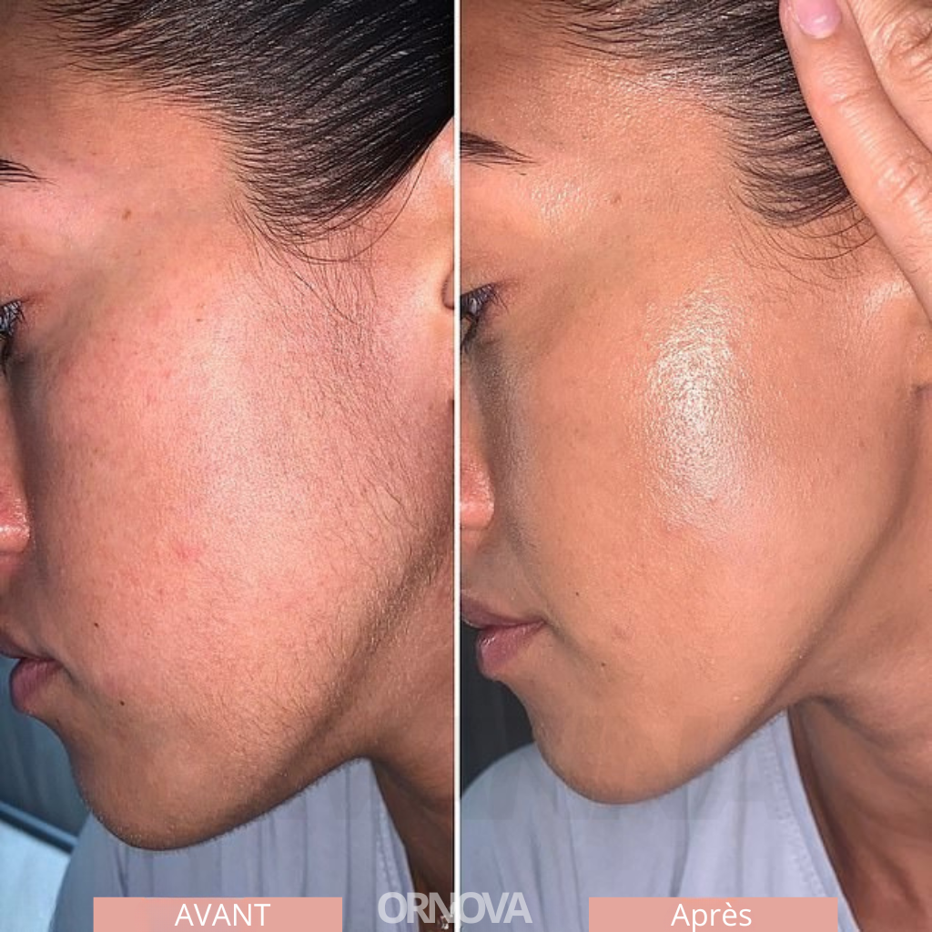 Ornova Tondeuse de précision pour sourcils et visage